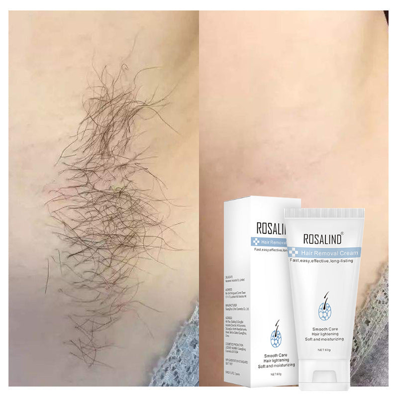 Hair removal