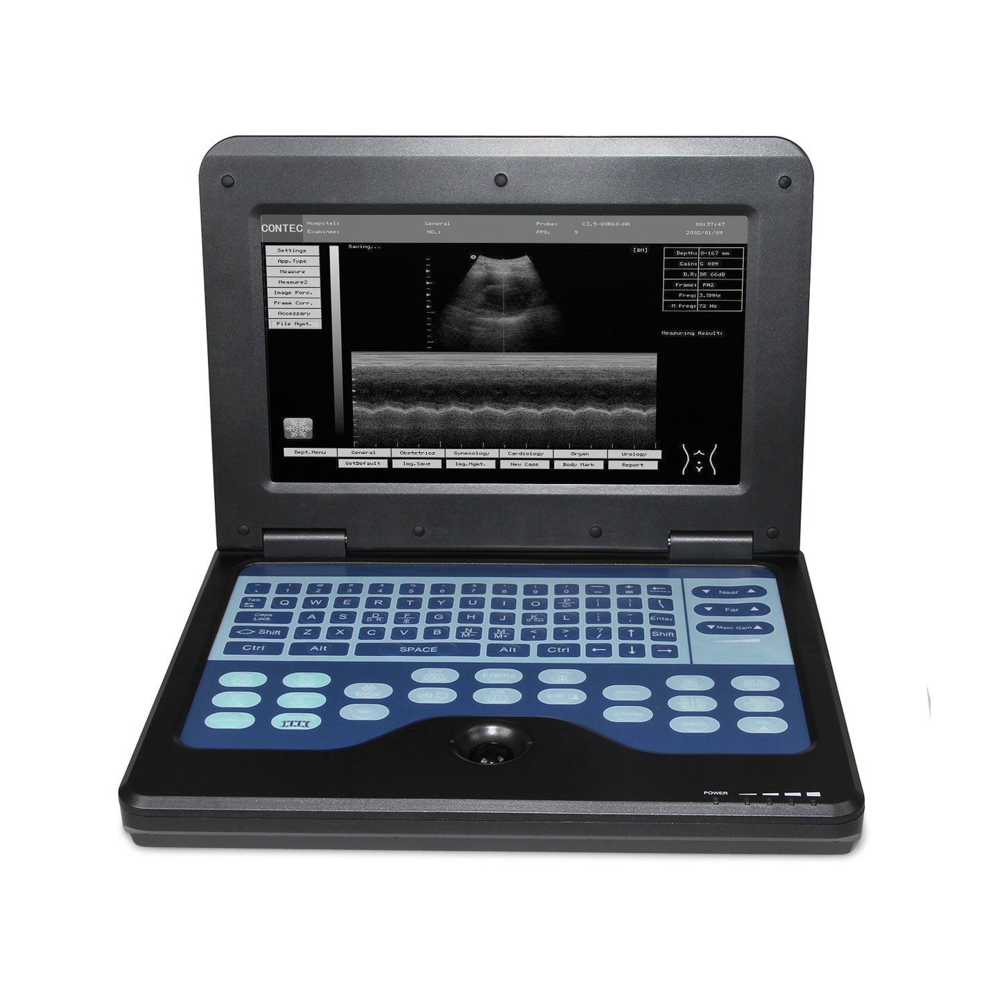 Digitale laptopmachine, echografiescanner, convex, 3,5 MHz, sonde, abdominaal, voor menselijk gebruik