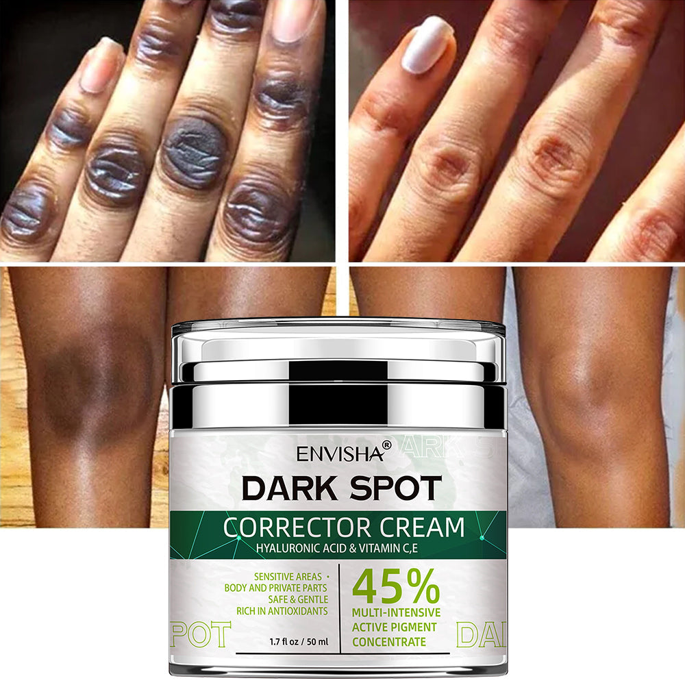 Natural Vegan Dark Spot Remover